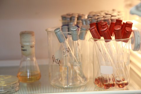 Impfösen zur Vereinzelung von Mikroorganismen